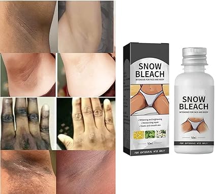 π₯Dark Spot Eraser Cream